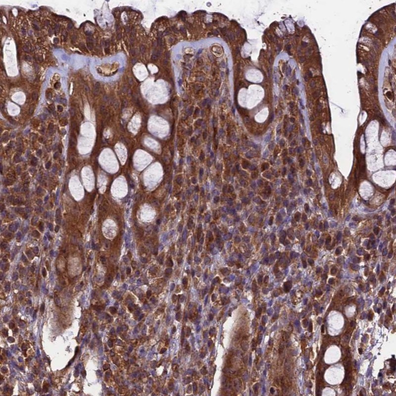 Anti-TTLL10 Antibody