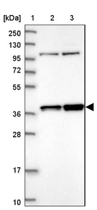 Lane 1: Marker [kDa] 250, 130, 95, 72, 55, 36, 28, 17, 10_br/_Lane 2: Human cell line RT-4_br/_Lane 3: Human cell line U-251MG sp