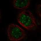 Immunofluorescent staining of human cell line A-431 shows localization to nucleus & nucleoli.