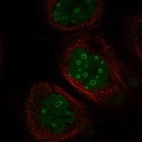 Immunofluorescent staining of human cell line A-431 shows localization to nucleus & nucleoli.