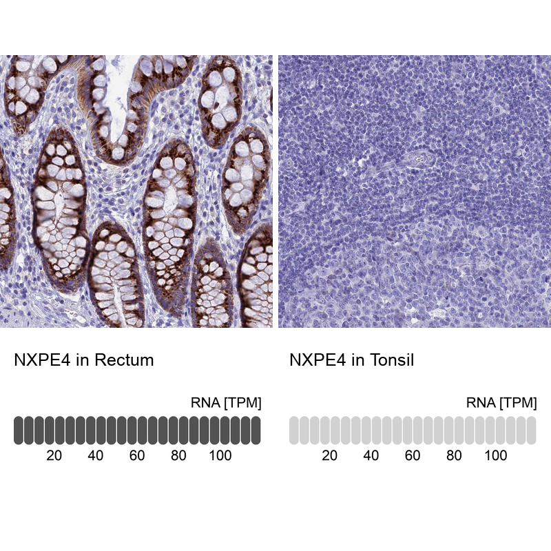 Anti-NXPE4 Antibody