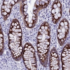 Immunohistochemical staining of human rectum shows strong granular cytoplasmic positivity in glandular cells.