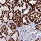 Immunohistochemical staining of human kidney shows strong granular cytoplasmic positivity in cells in tubules.