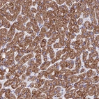 Immunohistochemical staining of human liver shows strong granular cytoplasmic positivity in hepatocytes.