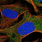 Immunofluorescent staining of human cell line U-2 OS shows localization to cytosol.
