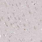 Anti-DIMT1 Antibody