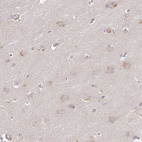 Immunohistochemical staining of human cerebral cortex shows weak nucleoli positivity in neurons.