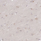 Immunohistochemical staining of human cerebral cortex shows weak nucleoli positivity in neurons.