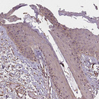 Immunohistochemical staining of human squamous epithelia shows weak positivity in nucleoli in squamous epithelial cells.