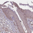 Immunohistochemical staining of human squamous epithelia shows weak positivity in nucleoli in squamous epithelial cells.
