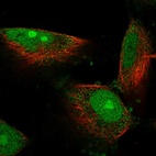 Immunofluorescent staining of human cell line U-251 MG shows localization to nucleus, nucleoli & cytosol.