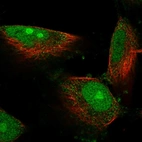 Immunofluorescent staining of human cell line U-251 MG shows localization to nucleus, nucleoli & cytosol.