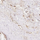 Anti-LYVE1 Antibody