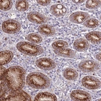 Anti-RGS11 Antibody