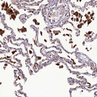 Anti-IRAK3 Antibody
