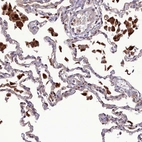 Anti-IRAK3 Antibody