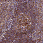 Immunohistochemical staining of human tonsil shows strong cytoplasmic positivity in germinal and non germinal center cells.