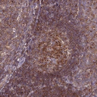 Immunohistochemical staining of human tonsil shows strong cytoplasmic positivity in germinal and non germinal center cells.