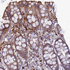 Immunohistochemical staining of human gastrointestinal shows strong cytoplasmic positivity in peripheral leukocytes.