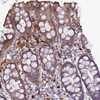 Immunohistochemical staining of human gastrointestinal shows strong cytoplasmic positivity in peripheral leukocytes.