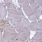 Immunohistochemical staining of human skeletal muscle shows low positivity in myocytes as expected.