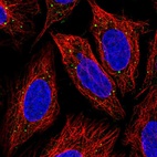 Immunofluorescent staining of human cell line SiHa shows localization to vesicles.