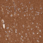 Immunohistochemical staining of human cerebral cortex shows strong positivity in neuropil.
