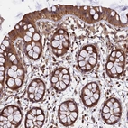 Immunohistochemical staining of human rectum shows strong cytoplasmic positivity in glandular cells.