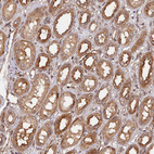 Immunohistochemical staining of human kidney shows moderate cytoplasmic positivity in cells in tubules.