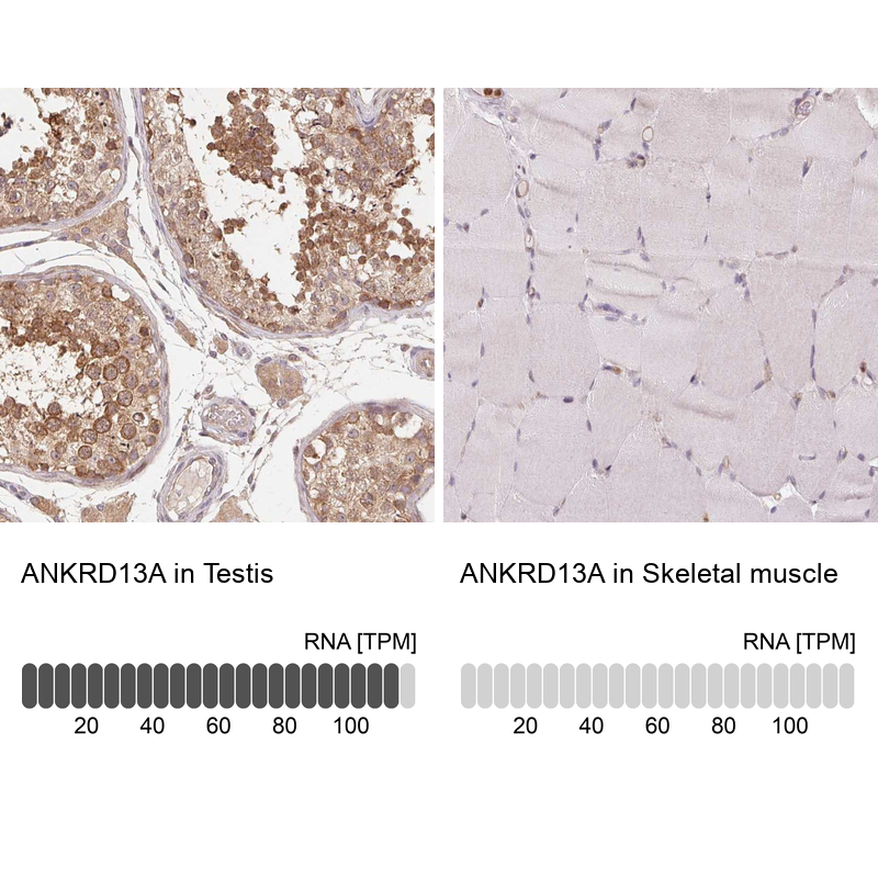 Anti-ANKRD13A Antibody