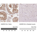 Anti-ANKRD13A Antibody