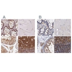 Immunohistochemical staining of human colon, skeletal muscle, testis and tonsil using Anti-ANKRD13A antibody HPA043218 (A) shows similar protein distribution across tissues to independent antibody HPA039488 (B).