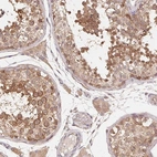 Immunohistochemical staining of human testis shows high expression.