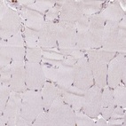 Immunohistochemical staining of human skeletal muscle shows low expression as expected.
