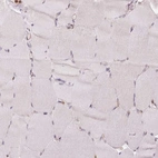 Immunohistochemical staining of human skeletal muscle shows low expression as expected.