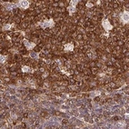 Immunohistochemical staining of human tonsil using Anti-ANKRD13A antibody HPA043218.