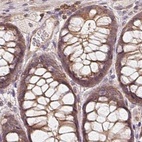 Immunohistochemical staining of human colon using Anti-ANKRD13A antibody HPA043218.