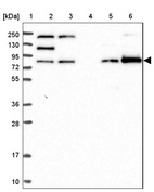 Lane 1: Marker [kDa] 250, 130, 95, 72, 55, 36, 28, 17, 10_br/_Lane 2: Human cell line RT-4_br/_Lane 3: Human cell line U-251 MG_br/_Lane 4: Human plasma_br/_Lane 5: Human Liver tissue_br/_Lane 6: Human Tonsil tissue