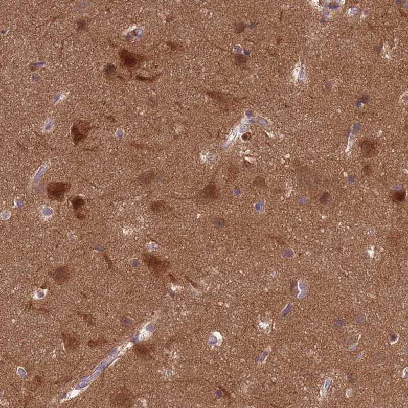 Anti-PPP2CA Antibody