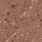 Anti-PPP2CA Antibody