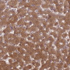 Immunohistochemical staining of human liver shows strong cytoplasmic positivity in hepatocytes.