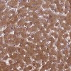 Immunohistochemical staining of human liver shows strong cytoplasmic positivity in hepatocytes.