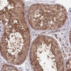 Immunohistochemical staining of human testis shows strong cytoplasmic positivity in cells in seminiferous ducts.