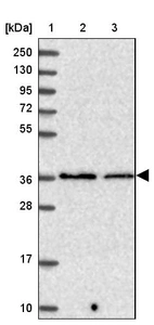 Lane 1: Marker [kDa] 250, 130, 95, 72, 55, 36, 28, 17, 10_br/_Lane 2: Human cell line RT-4_br/_Lane 3: Human cell line U-251 MG