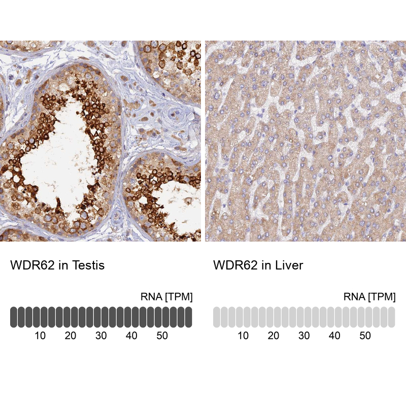 Anti-WDR62 Antibody