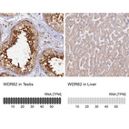 Anti-WDR62 Antibody