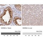 Anti-WDR62 Antibody