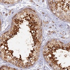 Anti-WDR62 Antibody