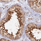 Immunohistochemical staining of human testis shows high expression.