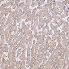 Immunohistochemical staining of human liver shows low expression as expected.